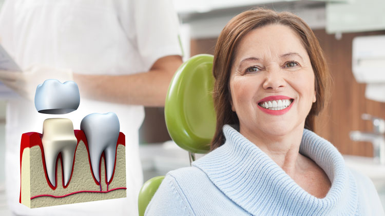 Precautionary Steps Needed to Take Care Of Your Temporary Dental Crown